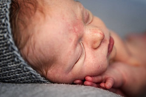 Vacinação BCG em recém-nascidos deve ser adiada até cinco semanas após rastreio neonatal
