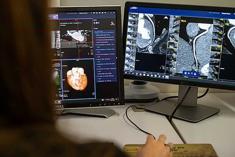 Identificados mecanismos do envelhecimento que potenciam células cancerígenas