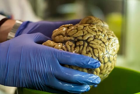 Entes queridos "têm certamente lugar no cérebro", diz neurocientista Winrich Freiwald