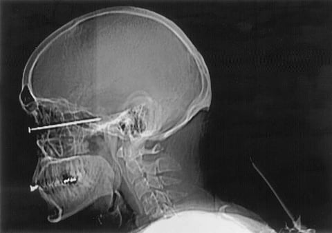 Concorrência condena cartel em concursos públicos em hospitais a coima de 6,9 milhões de euros