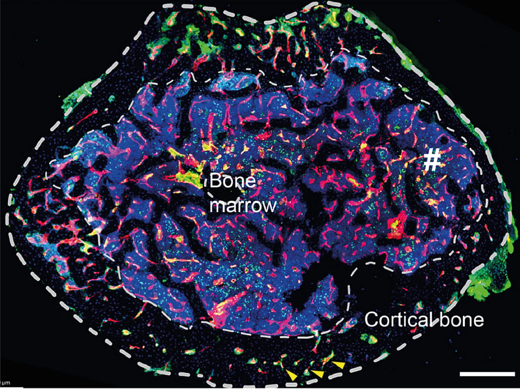 Coimbra scientists discover lymphatic vessels in bones and rewrite anatomy