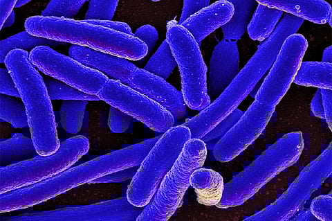 इंजीनियरों ने हानिकारक ई.कोलाई को पानी से हटाने की नई विधि की ईजाद