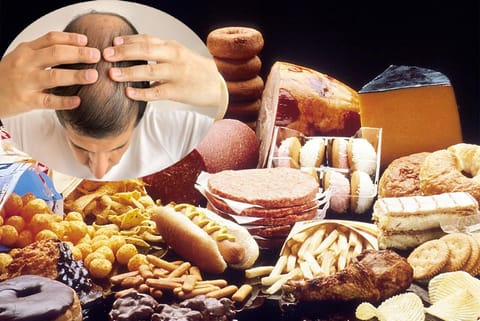 आपको अपने सर के बाल बचाने हैं तो कम खाएं वसा युक्त भोजन : अध्ययन