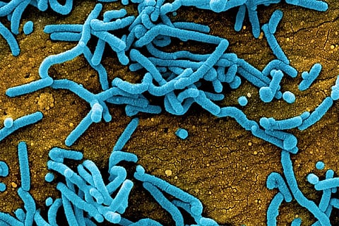 कितना घातक है पश्चिम अफ्रीका में मिले 'मारबर्ग वायरस' से होने वाला रोग 