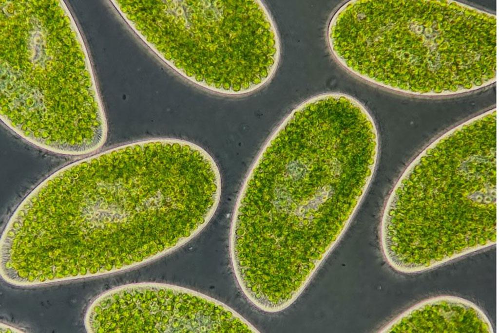 प्रोटिस्ट पैरामीशियम बर्सारिया पीटलैंड में आम तौर पर पाए जाने वाले काई में रहने वाले सूक्ष्मजीवों में से एक हैं। फोटो साभार: डेनियल विएक्ज़िनस्की, ड्यूक विश्वविद्यालय