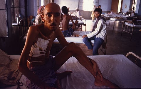 बड़ा होने पर दोबारा लगे बीसीजी का टीका तो टल सकता है टीबी का खतरा