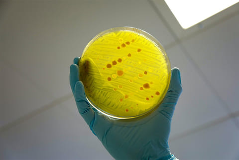 एएमआर मुख्य रूप से रोगाणुरोधी दवाओं के दुरुपयोग और अति प्रयोग के कारण होता है, फिर भी, दुनिया भर में कई लोगों के पास आवश्यक रोगाणुरोधी दवाओं तक पहुंच नहीं है। 