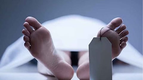 Representative Image