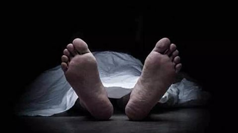 Representative image