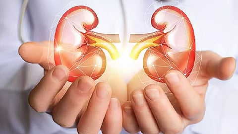 Representative Image