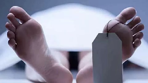 Representative image