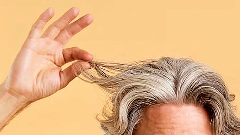 Premature greying of hair