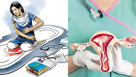 Regular menstruation doesn’t rule out cervical cancer