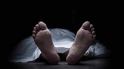 Representative image