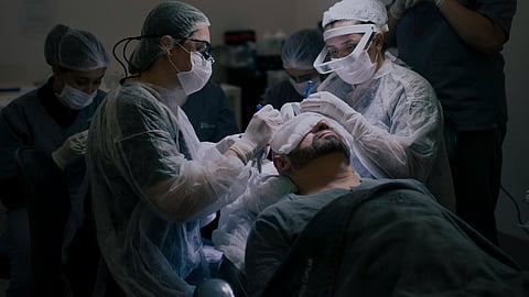 Representative Image for hair transplant 