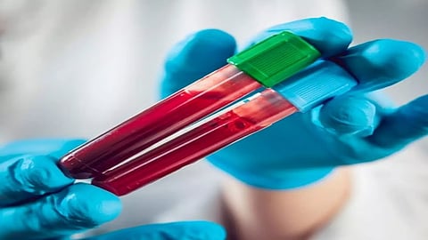 Representative image