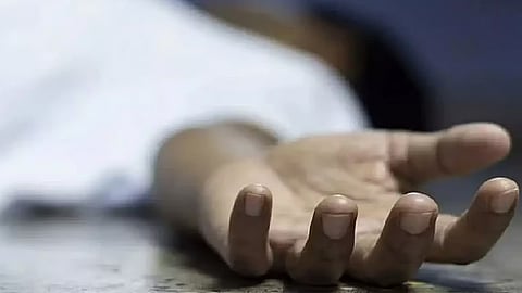 Representative Image