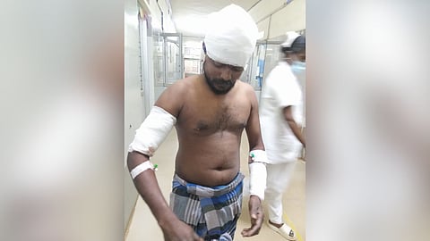 One of the injured victims of the second attack