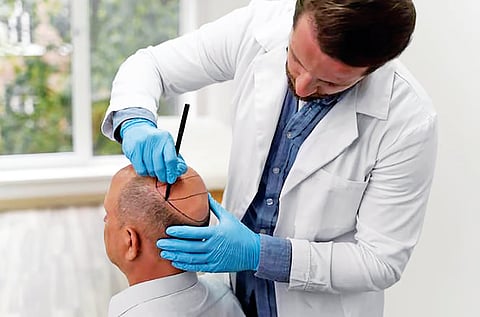 DT Next Tress Talk | Check-list to find authenticity of hair transplant clinics