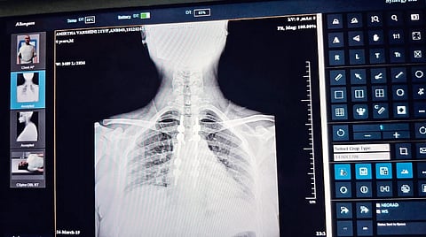 Picture of an X-ray
