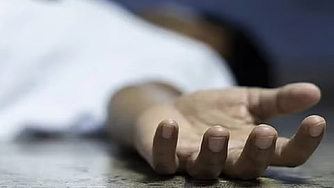 Representative Image