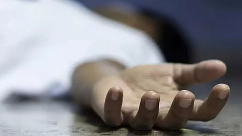 Representative Image