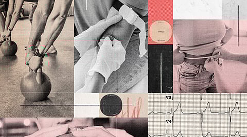 Representative image