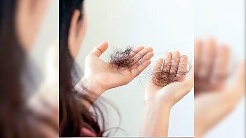 Hair loss