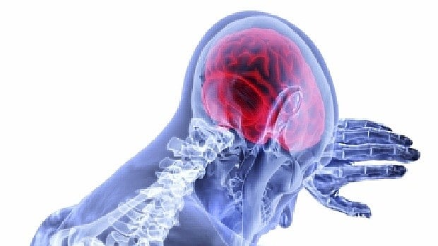 Death by stroke single largest cause of inpatient mortality at RGGGH: Study