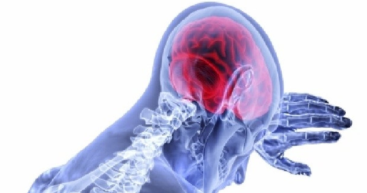 Death by stroke single largest cause of inpatient mortality at RGGGH: Study