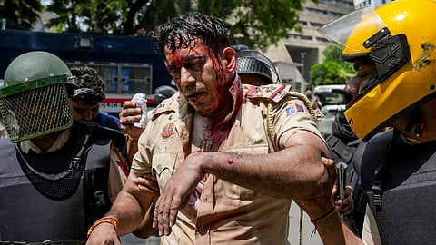 An injured police official being taken following stone-pelting amid the ongoing protest of Cockroach Janta Party (CJP) demanding the resignation of union education Minister Dharmendra Pradhan over the NEET paper leak issue
