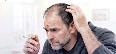 DT Tress Talk | Smoking and your hair: How the habit can thin air

