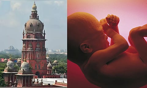 Madras High Court allows abortion of 32-week pregnancy over abnormalities

