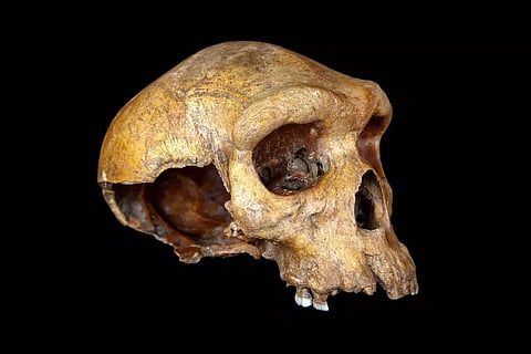 Representative image