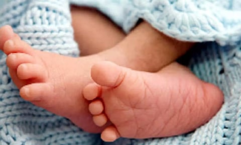 Representative image