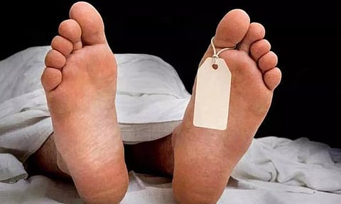 Representative image