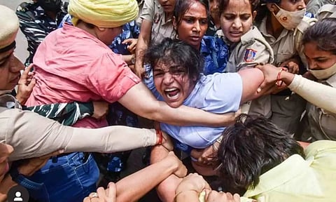 Representative image