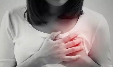 Representative Image