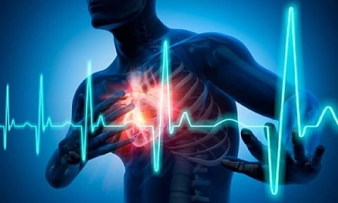 Representative image