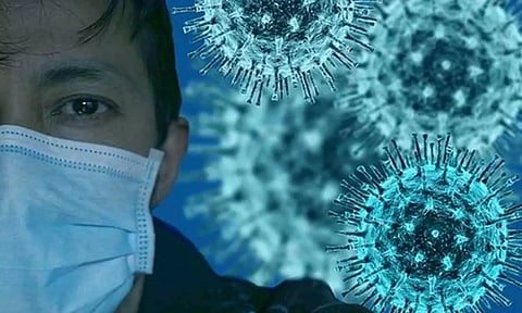 Representative Image