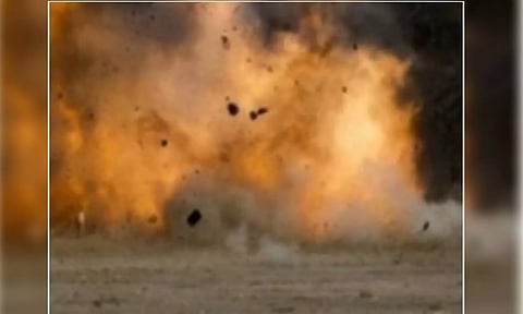 Representative Image