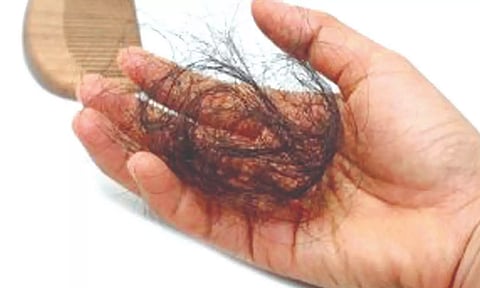 When to consult a dermatologist for hair fall?