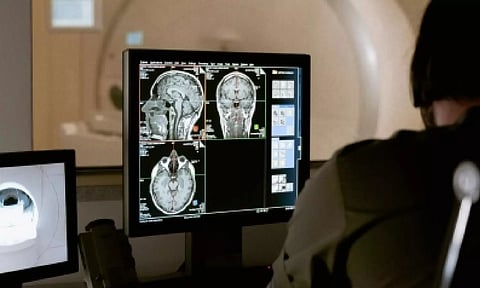 Representative image