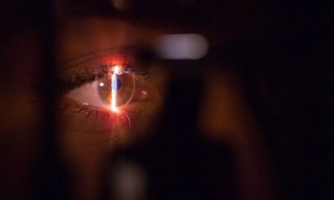 Representative image