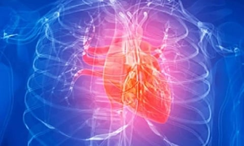 Representative image