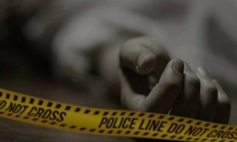 Representative image