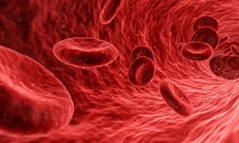 Representative image