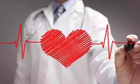 Representative image