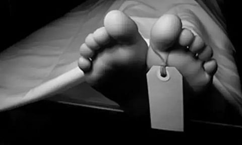 Representative image