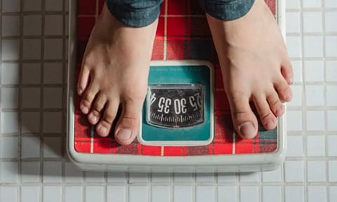 Representative image